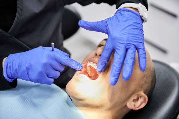 Best Broken or Cracked Tooth Emergency Dentist in Dexter, MO